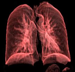 rüyada akciğer hastası olmak